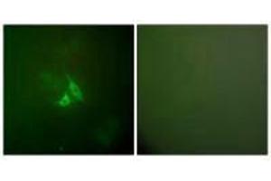 Immunofluorescence analysis of A549 cells, using Cox2 antibody. (PTGS2 antibody)