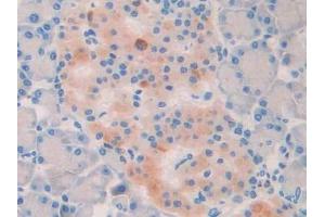 DAB staining on IHC-P; Samples: Rat Pancreas Tissue (LOXL2 antibody  (AA 434-546))