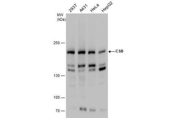 ERCC6 antibody  (Internal Region)