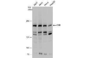 ERCC6 antibody  (Internal Region)