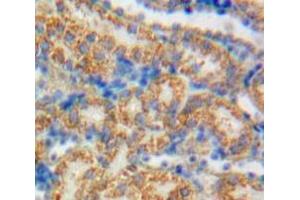 IHC-P analysis of Kidney tissue, with DAB staining. (GAS6 antibody  (AA 59-221))