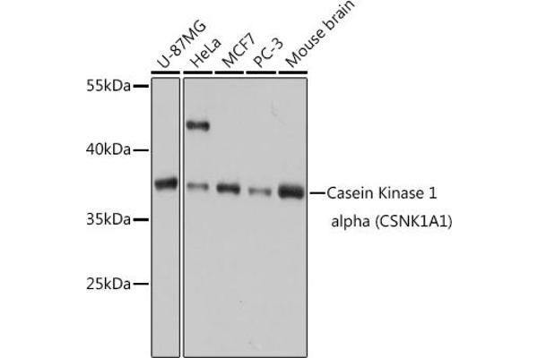 CSNK1A1 antibody  (AA 100-200)