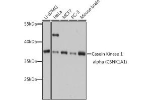 Western blot analysis of extracts of various cell lines, using Casein Kinase 1 alpha (Casein Kinase 1 alpha (CSNK1)) antibody (6225) at 1:1000 dilution. (CSNK1A1 antibody  (AA 100-200))