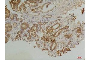 Immunohistochemistry (IHC) analysis of paraffin-embedded Human Prostate Tissue using Endothelin B Receptor Rabbit Polyclonal Antibody diluted at 1:200.