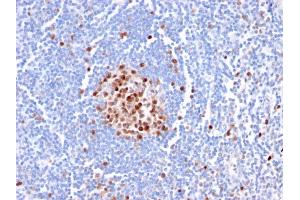 Formalin-fixed, paraffin-embedded human Tonsil stained with PCNA Mouse Monoclonal Antibody (PC5). (PCNA antibody)