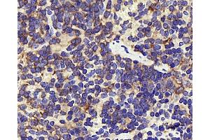 Immunohistochemistry analysis of paraffin-embedded mouse inflammation spleen using INPP5D Polyclonal Antibody at dilution of 1:300. (INPP5D antibody)
