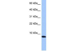 WB Suggested Anti-TNP1 Antibody Titration: 0. (TNP1 antibody  (N-Term))