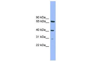 WB Suggested Anti-Rfxap Antibody Titration: 0. (RFXAP antibody  (N-Term))