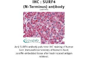 Image no. 1 for anti-Surfeit 4 (SURF4) (N-Term) antibody (ABIN1739778) (Surfeit 4 antibody  (N-Term))