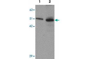 Western blot analysis of SLC39A7 in mouse brain tissue lysate with SLC39A7 polyclonal antibody  at (1) 0.