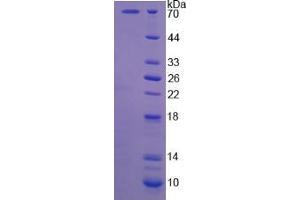 Image no. 1 for Calpain 5 (CAPN5) (AA 2-344) protein (His tag,GST tag) (ABIN5665146)