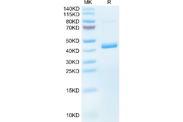 PF4 Protein (AA 30-105) (Fc Tag)