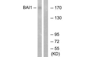 Western Blotting (WB) image for anti-Brain-Specific Angiogenesis Inhibitor 1 (BAI1) (Internal Region) antibody (ABIN6301192) (BAI1 antibody  (Internal Region))