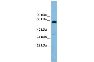 B4GALNT1 antibody used at 1 ug/ml to detect target protein. (B4GALNT1 antibody  (Middle Region))