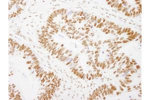 anti-General Transcription Factor III (GTF2I) (AA 985-998) antibody