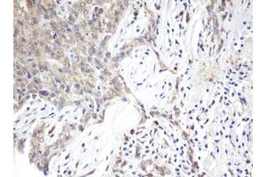 Image no. 1 for anti-ADP-Ribosylation Factor-Like 2 Binding Protein (ARL2BP) antibody (ABIN1496716) (ARL2BP antibody)