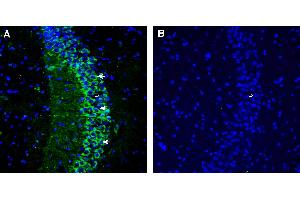 Expression of CaVβ2 in mouse hippocampus.