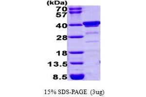 SDS-PAGE (SDS) image for Biliverdin Reductase A (BLVRA) (AA 3-296) protein (ABIN666791) (Biliverdin Reductase Protein (AA 3-296))