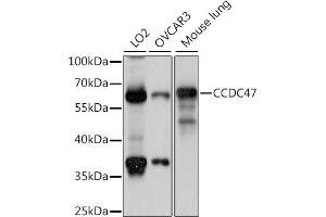 Western blot analysis of extracts of various cell lines, using CCDC47 antibody (ABIN7266438) at 1:1000 dilution. (CCDC47 antibody  (AA 224-483))