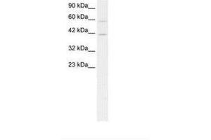 Image no. 1 for anti-CAMP Responsive Element Binding Protein 5 (CREB5) (AA 47-96) antibody (ABIN203172) (CREB5 antibody  (AA 47-96))