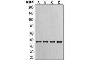 Western blot analysis of Cytokeratin 17 expression in PC12 (A), HeLa (B), A431 (C), NIH3T3 (D) whole cell lysates. (KRT17 antibody  (C-Term))