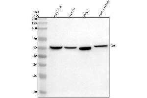 Western blot analysis of GSS using anti-GSS antibody (ABIN7825416).