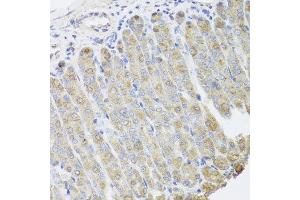 Immunohistochemistry of paraffin-embedded mouse stomach using BGLAP antibody at dilution of 1:100 (x40 lens). (Osteocalcin antibody)
