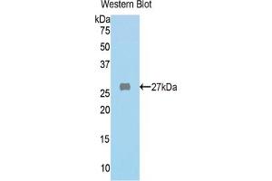 WB of Protein Standard: different control antibodies against Highly purified E. (FAH ELISA Kit)