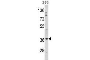 Image no. 1 for anti-Distal-Less Homeobox Protein 2 (DLX2) (Middle Region) antibody (ABIN452916) (DLX2 antibody  (Middle Region))