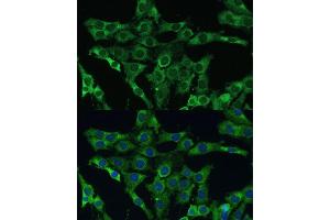 Immunofluorescence analysis of C6 cells using PLSCR3 Polyclonal Antibody (ABIN6132499, ABIN6145798, ABIN6145799 and ABIN6215981) at dilution of 1:100 (40x lens). (PLSCR3 antibody  (AA 1-295))
