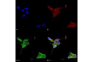 Immunocytochemistry/Immunofluorescence analysis using Mouse Anti-TrpM7 Monoclonal Antibody, Clone S74 (ABIN2483107).