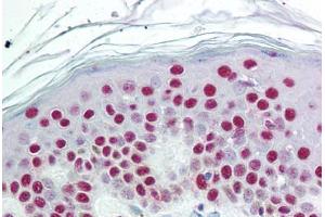 Human Skin (formalin-fixed, paraffin-embedded) stained with SET antibody ABIN297641 at 10 ug/ml followed by biotinylated goat anti-rabbit IgG secondary antibody ABIN481713, alkaline phosphatase-streptavidin and chromogen. (SET/TAF-I antibody  (AA 66-81))