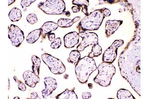 IHC analysis of Calpastatin using anti-Calpastatin antibody . (Calpastatin antibody  (Middle Region))