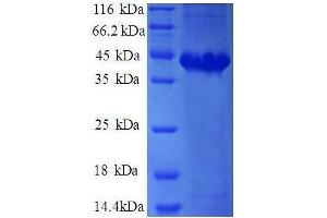 Adaptor-Related Protein Complex 2, sigma 1 Subunit (AP2S1) (AA 1-142), (full length) protein (GST tag) (AP2S1 Protein (AA 1-142, full length) (GST tag))