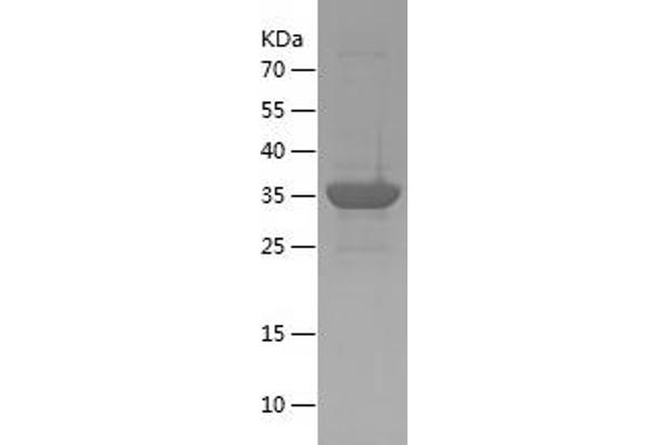 FAM119A Protein (AA 93-218) (His-IF2DI Tag)