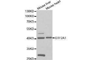 Western blot analysis of extracts of various cell lines, using GTF2A1 antibody (ABIN5973082) at 1/1000 dilution. (GTF2A1 antibody)