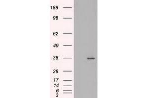 HEK293T cells were transfected with the pCMV6-ENTRY control (Left lane) or pCMV6-ENTRY BFGF (RC217426) (Right lane) cDNA for 48 hrs and lysed. (FGF2 antibody  (AA 10-155))