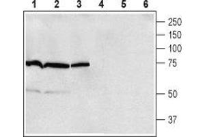 Western blot analysis of rat brain (lanes 1 and 4), mouse brain (lanes 2 and 5) and rat lung (lanes 3 and 6) membranes: - 1-3. (ADRB1 antibody  (2nd Extracellular Loop))