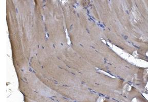 IHC analysis of PAK2 using anti-PAK2 antibody (ABIN7599219).