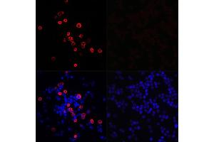 Immunofluorescence analysis of 293T cells transfected with SARS-CoV-2 3CLpro fusion protein (top left) and untreated 293T cells (top right) use SARS-CoV-2 3CLpro Rabbit pAb (ABIN7270151) at dilution of 1:100 (40x lens). (SARS-Coronavirus Nonstructural Protein 8 (SARS-CoV NSP8) antibody)
