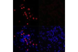 Immunofluorescence analysis of 293T cells transfected with SARS-CoV-2 3CLpro fusion protein (top left) and untreated 293T cells (top right) use SARS-CoV-2 3CLpro Rabbit pAb (ABIN7270151) at dilution of 1:100 (40x lens). (SARS-Coronavirus Nonstructural Protein 8 (SARS-CoV NSP8) antibody)