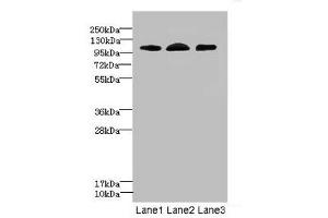 Western blot All lanes: EPHB4 antibody at 2. (EPH Receptor B4 antibody  (AA 300-540))
