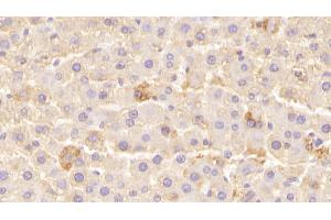Detection of LEPR in Rat Liver Tissue using Polyclonal Antibody to Leptin Receptor (LEPR) (Leptin Receptor antibody  (AA 238-375))