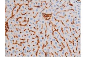 Immunohistochemistry (IHC) image for anti-Insulin Receptor Substrate 1 (IRS1) (pSer312) antibody (ABIN6256264)