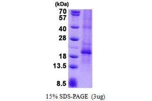 Image no. 1 for Chorionic Gonadotropin, beta Polypeptide (CGB) protein (His tag) (ABIN1098801)