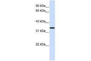 C16ORF78 antibody used at 1 ug/ml to detect target protein. (C16orf78 antibody  (Middle Region))