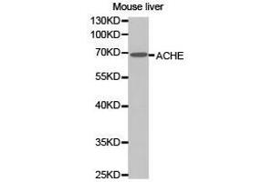 Western Blotting (WB) image for anti-Acetylcholinesterase (AChE) antibody (ABIN1870760) (Acetylcholinesterase antibody)