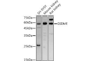 Western blot analysis of extracts of various cell lines, using GSDME antibody (ABIN6127757, ABIN6139554, ABIN6139555 and ABIN6223304) at 1:1000 dilution. (Non-Syndromic Hearing Impairment Protein 5 (GSDME) (AA 1-260) antibody)