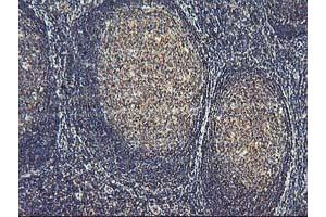 Image no. 6 for anti-Activating Signal Cointegrator 1 Complex Subunit 1 (ASCC1) antibody (ABIN1496741) (ASCC1 antibody)