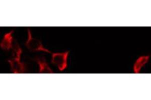 ABIN6274642 staining HeLa by IF/ICC. (CYP27A1 antibody  (C-Term))